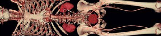 Multi-slice CT Explained